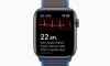 Apple Watch EKG algoritmasını güncelledi